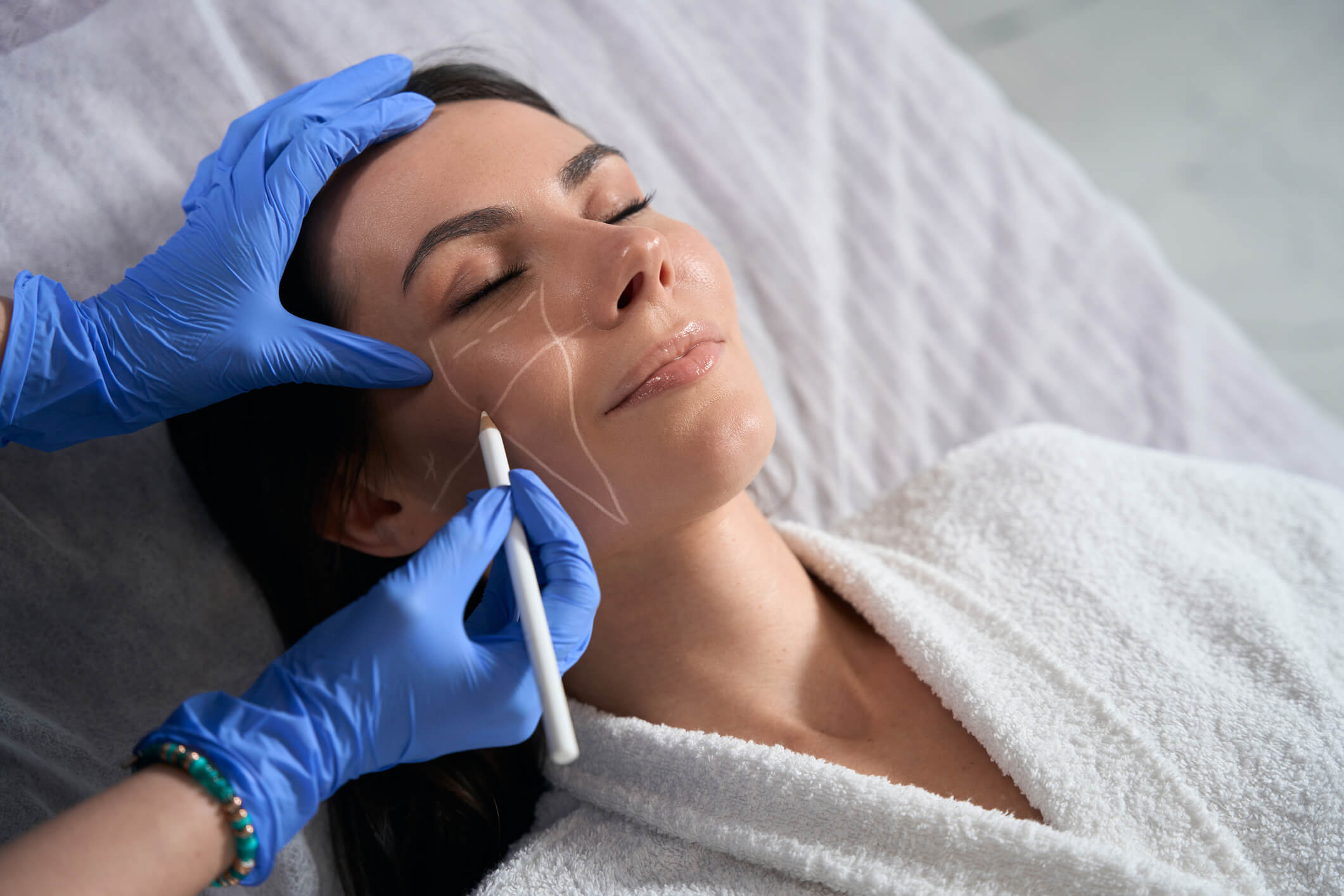 Clinician marking woman's face for cosmetic procedure