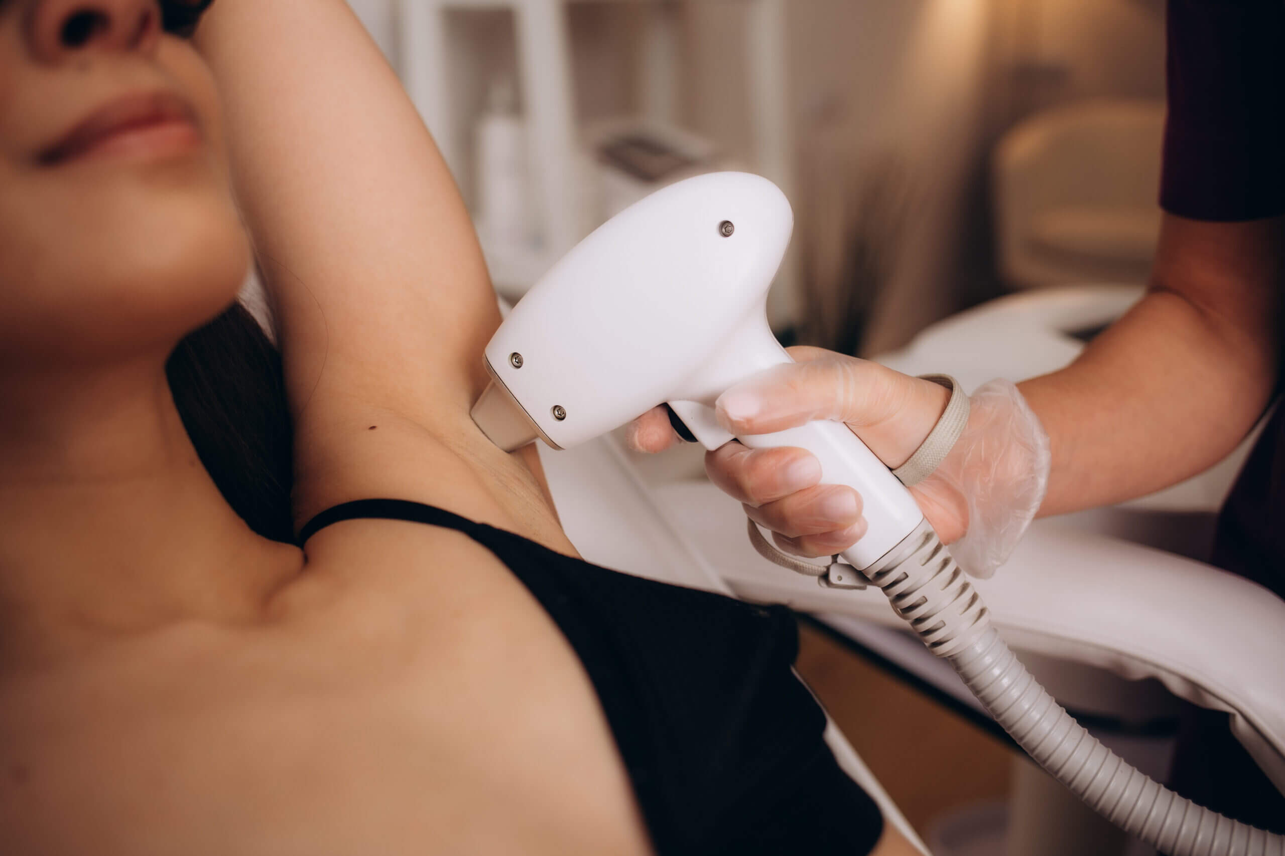 Close-up underarm laser hair removal treatment